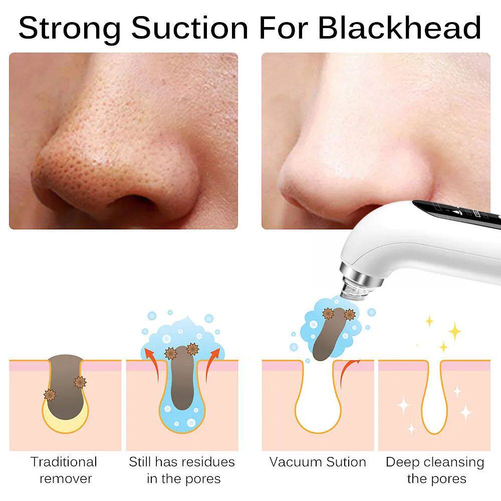 Electric Pore Vacuum Cleaner with Water Cycle Deep Cleansing System